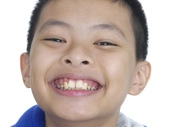 Close-up of a child smiling, showing bright, healthy teeth.