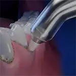 Waterpik™ Pik Pocket™ Tip