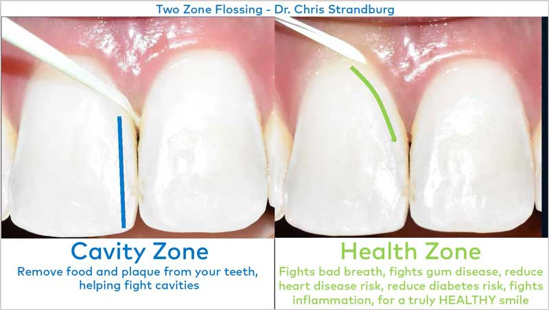 Two-zone flossing diagram: cavity zone (left, blue line) shows floss between teeth; health zone (right, green line) shows floss below the gumline.