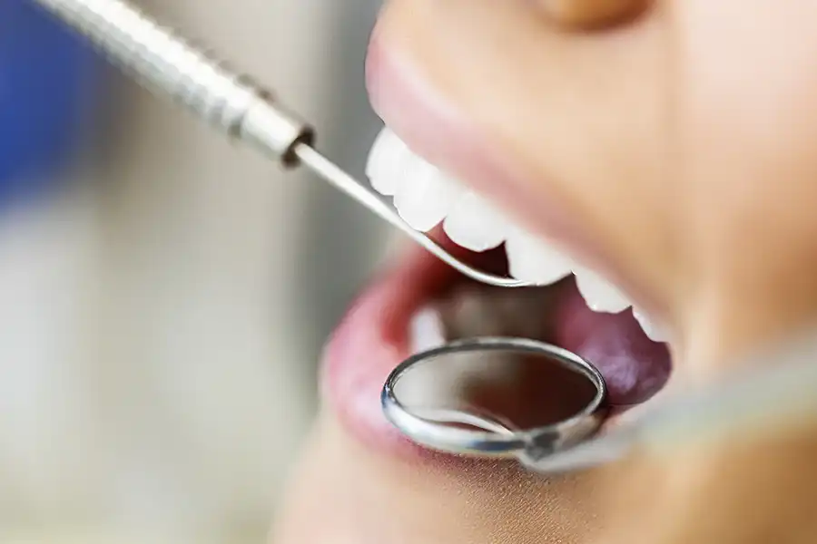 Woman's mouth being probed by dental professional