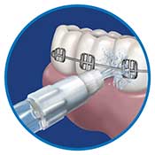 Orthodontic Tip OD-100E