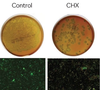 Waterpik Water Flosser removes 90% of biofilm on titanium implant