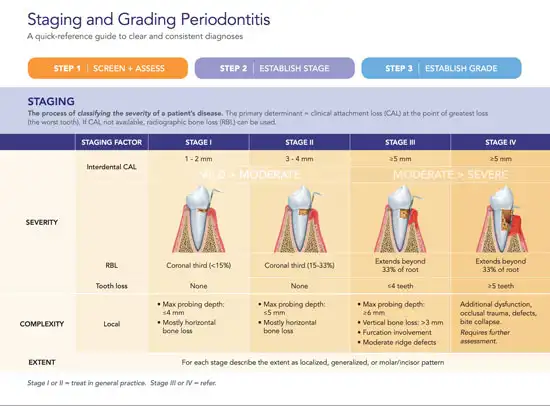 AAP Periodontal Disease Classification System Chairside Guide