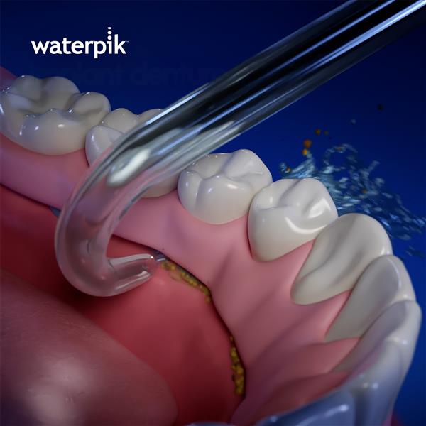 Using the Waterpik Implant Tip on Lower Arch 